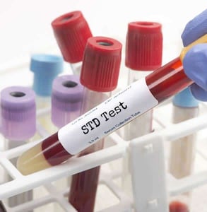 Photo of an STD test Photo of an STD test