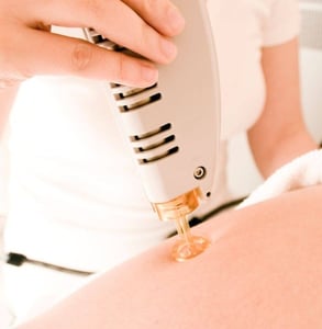 Romeo & Juliette Laser Hair Removal Romeo & Juliette Laser Hair Removal