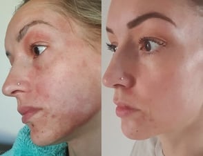Before and after photo from UpCircle